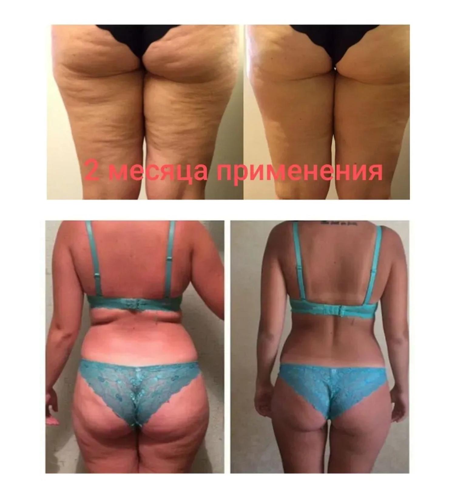 CreamsPack Anti -cellulite weight loss cream 500ml - Buy Online on GoSupps.com