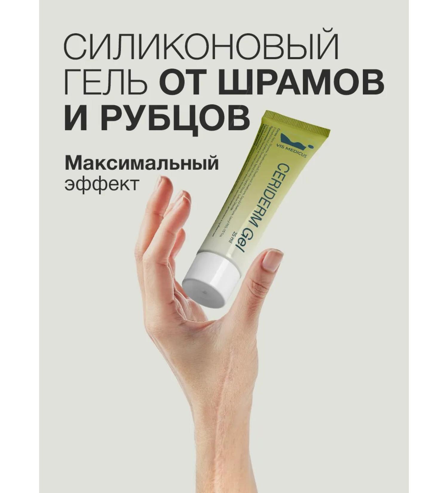 VIS MEDICUS Cream from scars and scars - Buy Online on GoSupps.com