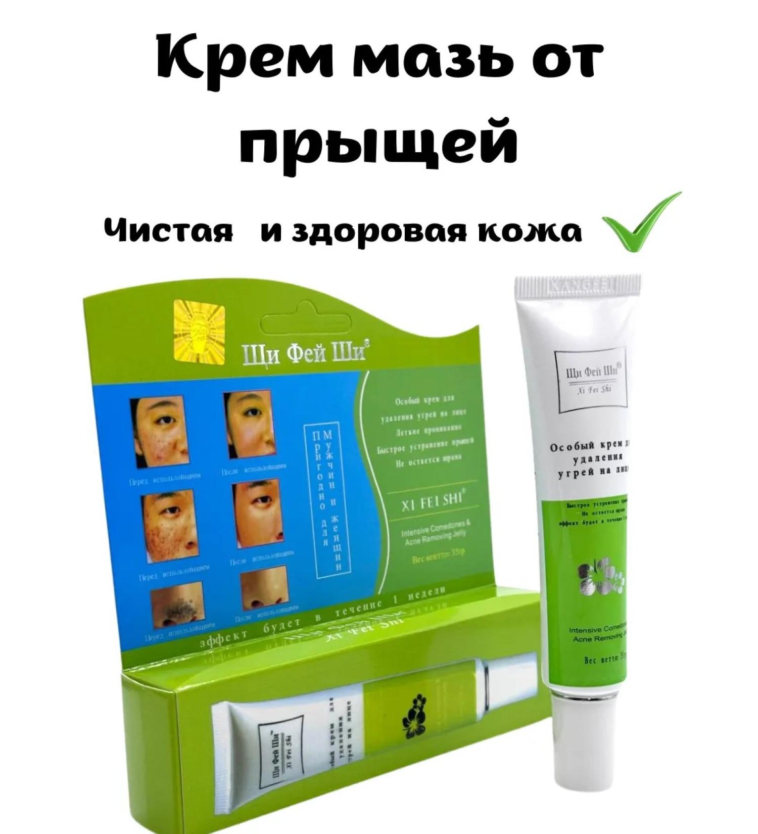 Karat 5 Ointment-cream from acne - Buy Online on GoSupps.com