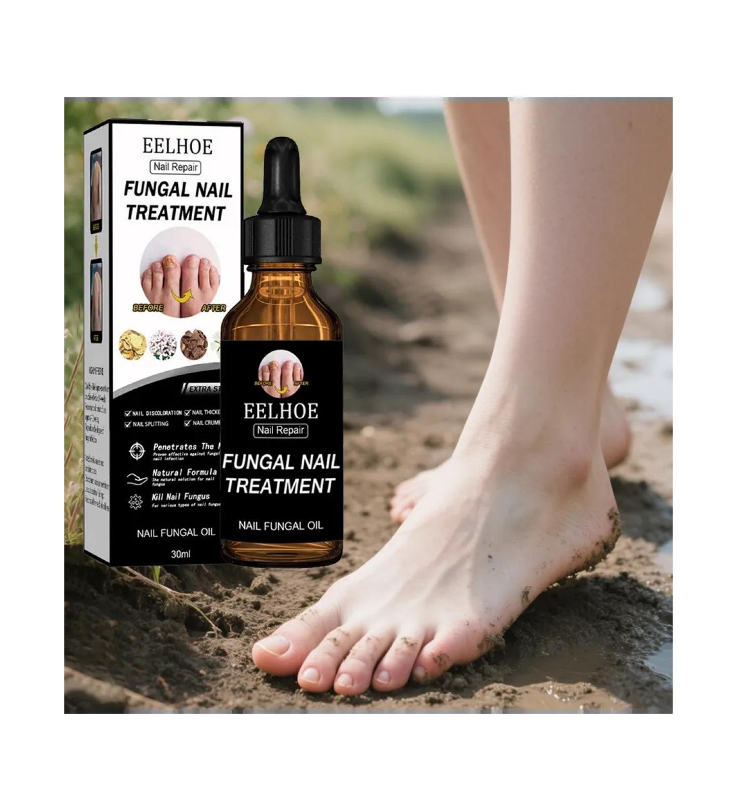 Treatment of nail fungus recovery panthenol glycerin - Buy Online on GoSupps.com