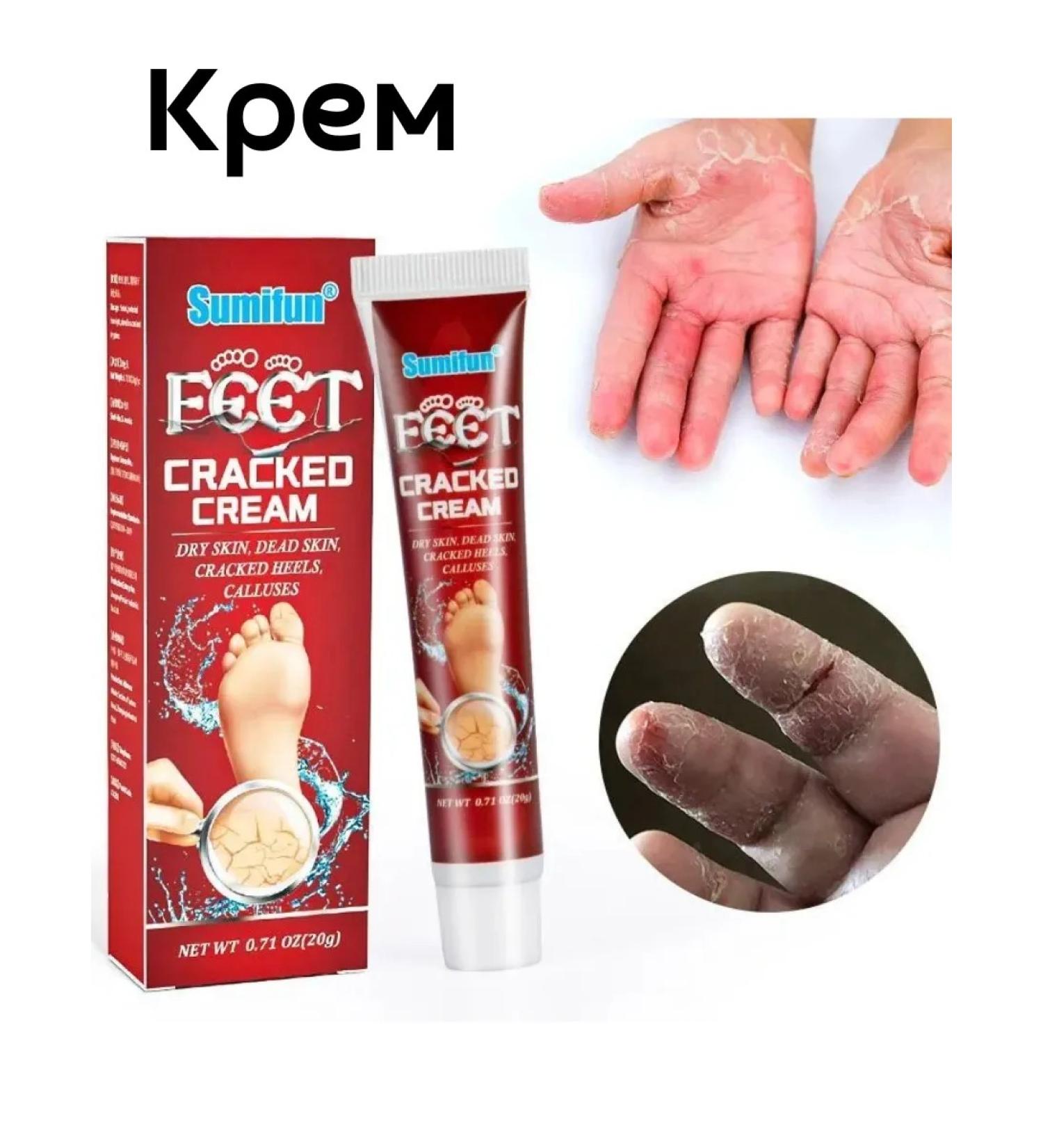 Frost for the legs cream for hands and legs - Buy Online on GoSupps.com