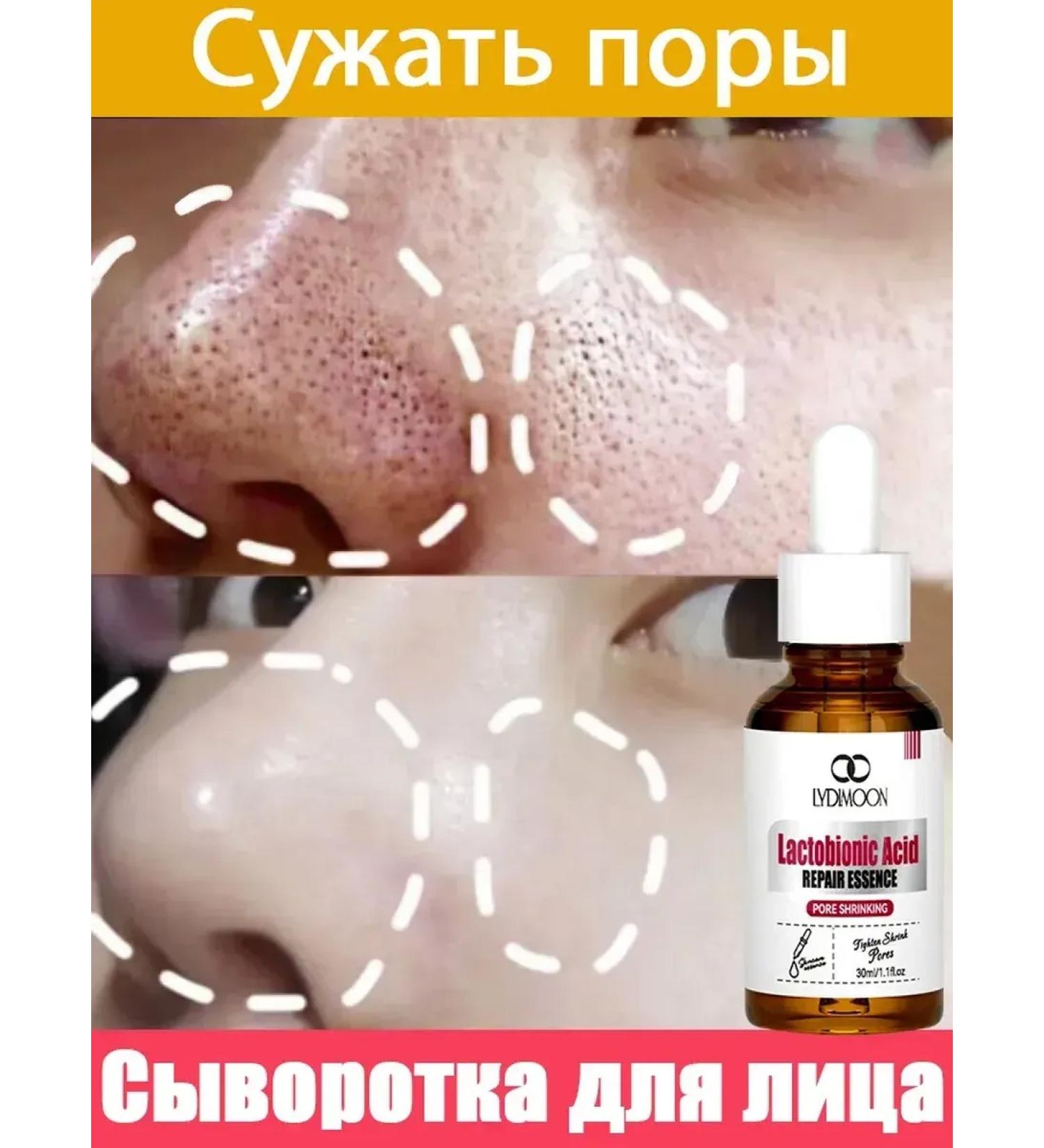 LYDIMOON Korea's face serum from extended pores on the face of 30 ml - Buy Online on GoSupps.com