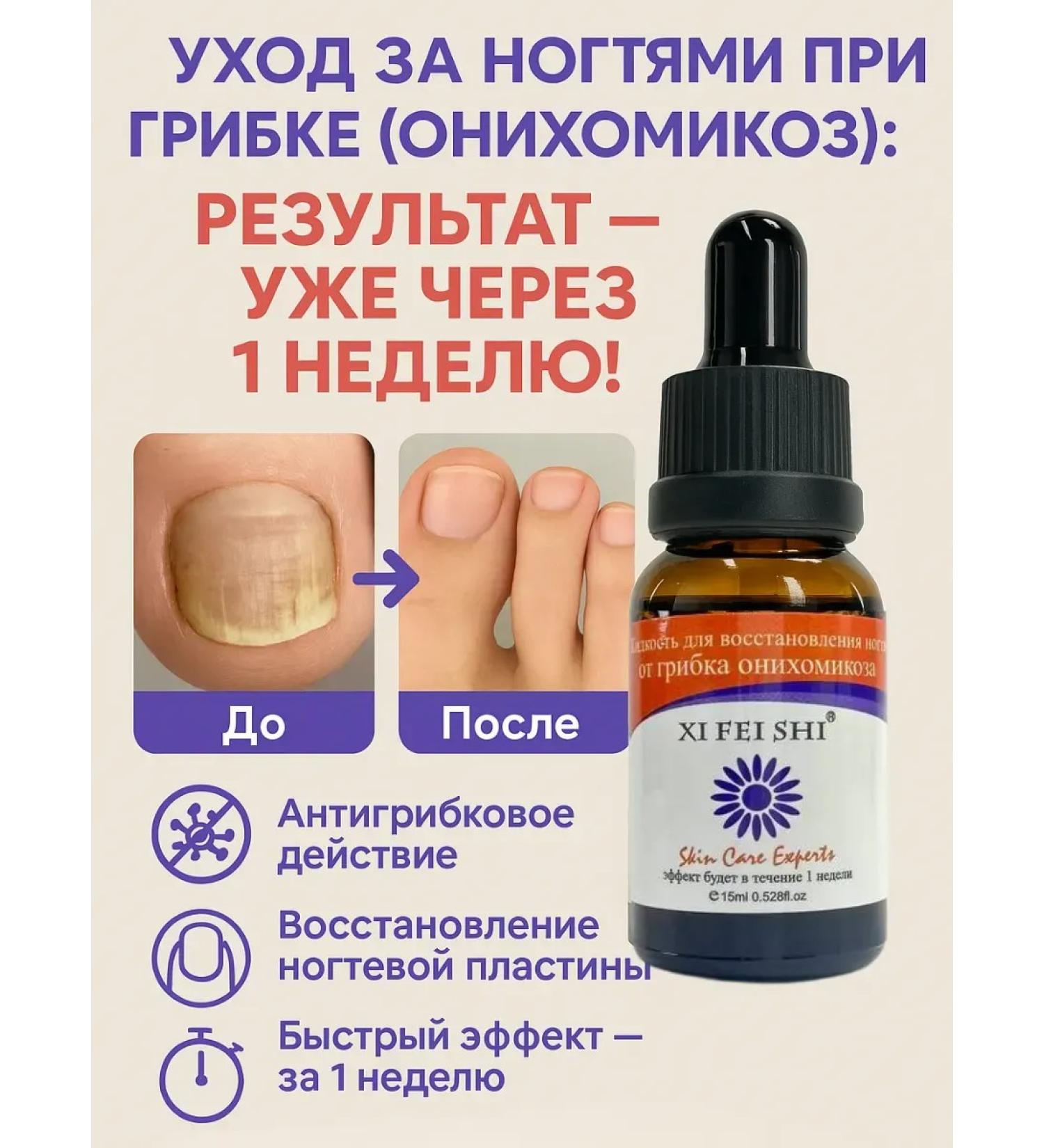 Remedy for nail and skin fungus restoration - Buy Online on GoSupps.com