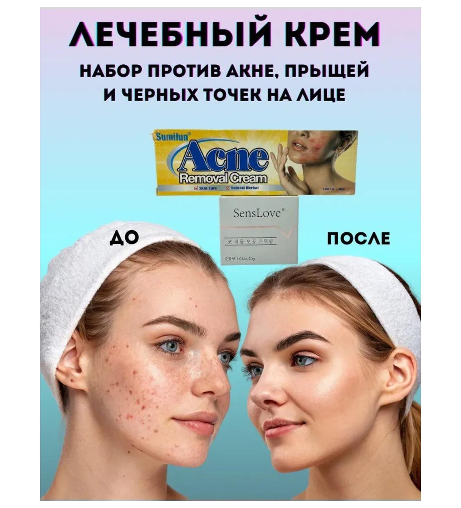 Everbloom Acne and black dots cream narrows pores set - Buy Online on GoSupps.com