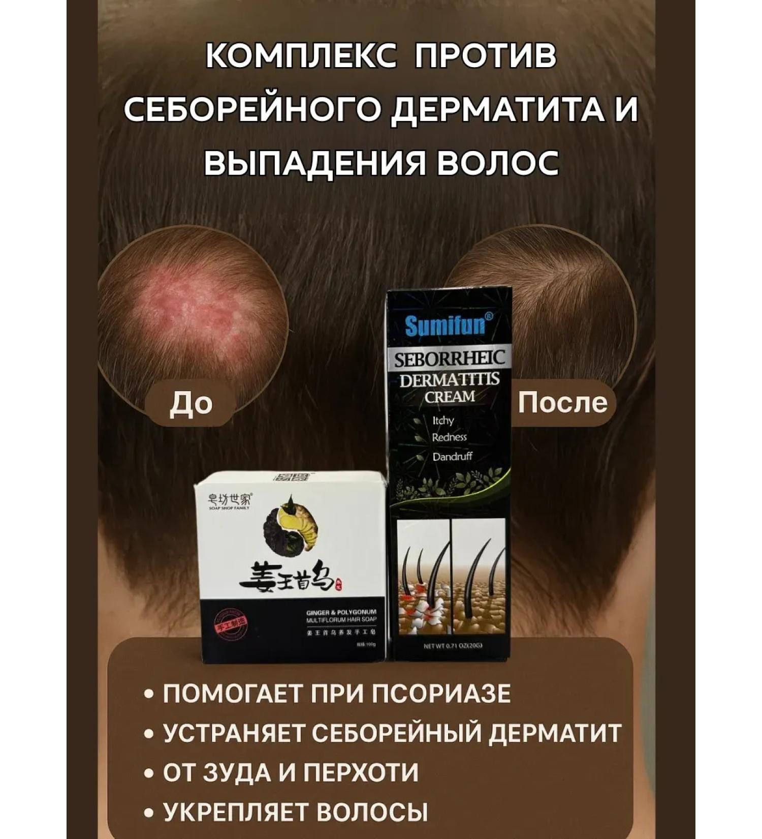 AllenGo Cream + soap for the treatment of seborrhea and hair loss - Buy Online on GoSupps.com