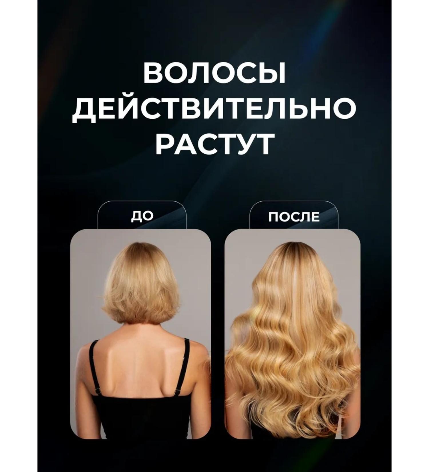 IKKI LV Hair growth whey against falling out - Buy Online on GoSupps.com