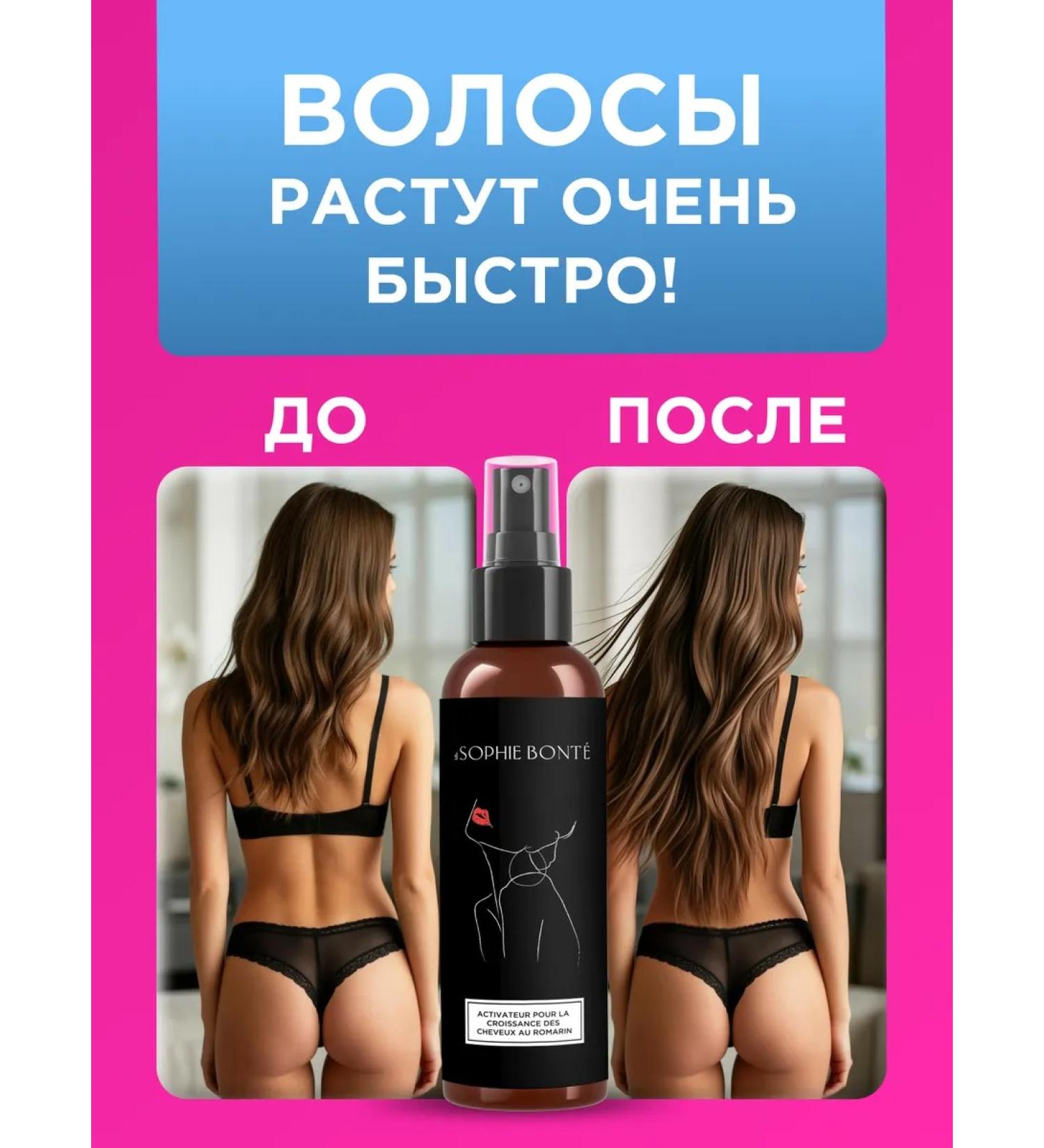 SOPHIE BONTE SB Hair growth with rosemary activator - Buy Online on GoSupps.com
