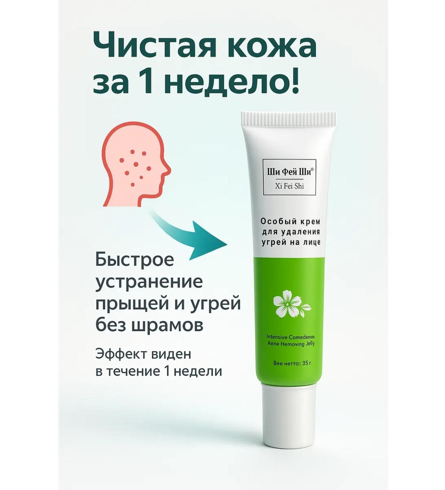 Franklin Acne cream for face - Buy Online on GoSupps.com