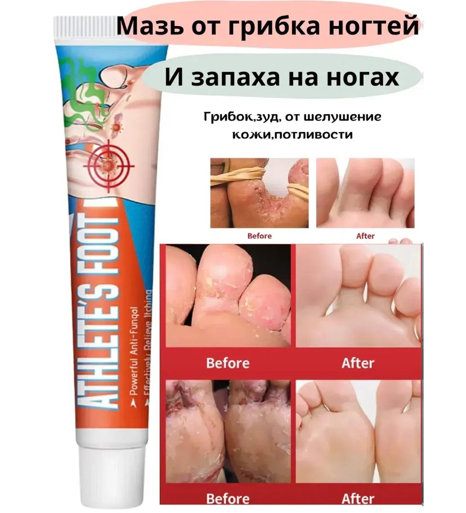 Wellness cosmetics Ointment from nail fungus and from the smell of the legs antifungal - Buy Online on GoSupps.com