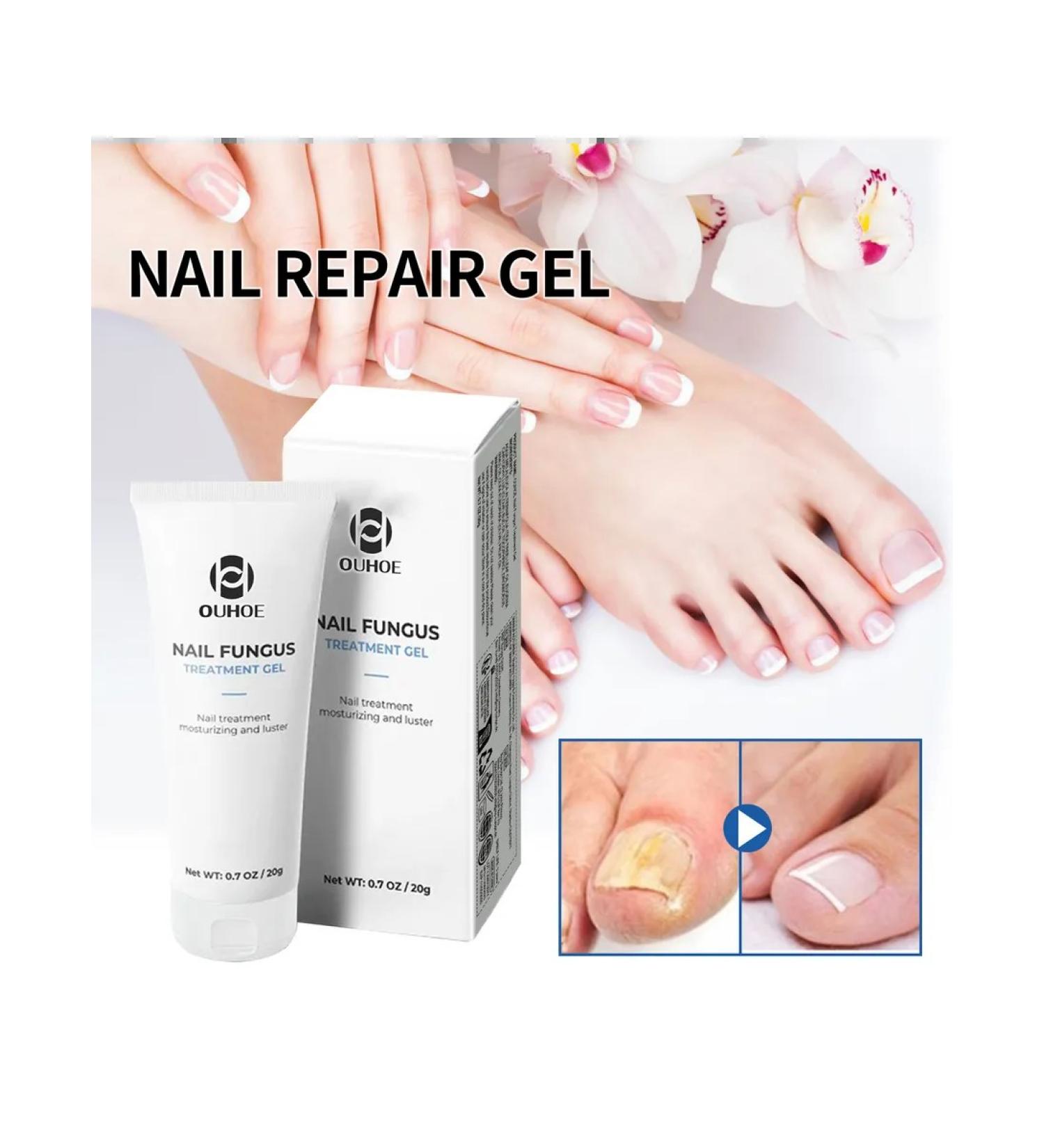 Ouhoe gel to care for nail fungus - Buy Online on GoSupps.com