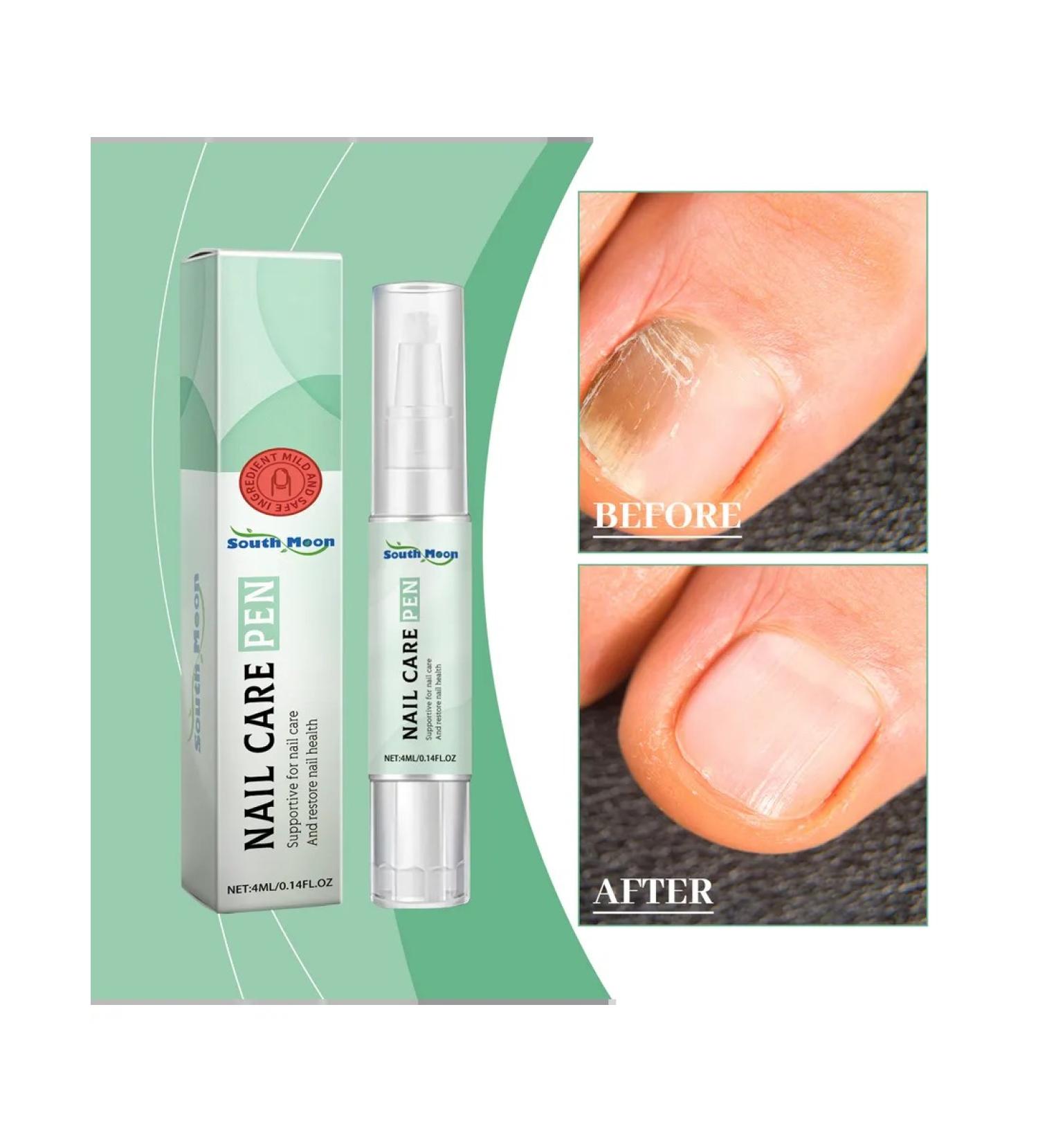 South Moon Gray Pencil for Nail Restore - Buy Online on GoSupps.com