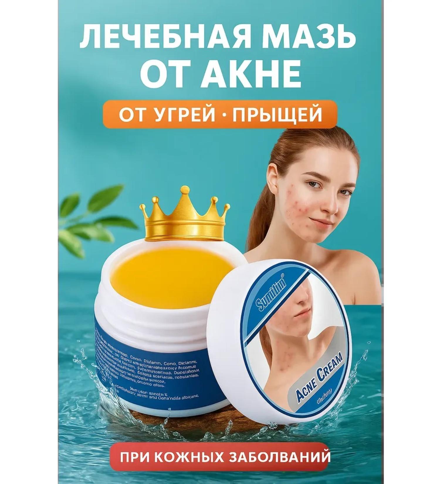 Fortune Therapeutic ointment from acne acne and acne - Buy Online on GoSupps.com