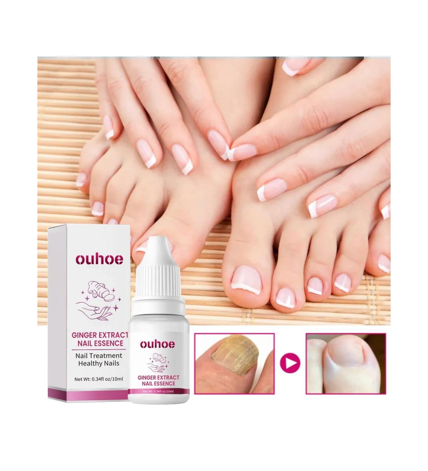 Extract with ginger Extract quickly improves - Buy Online on GoSupps.com