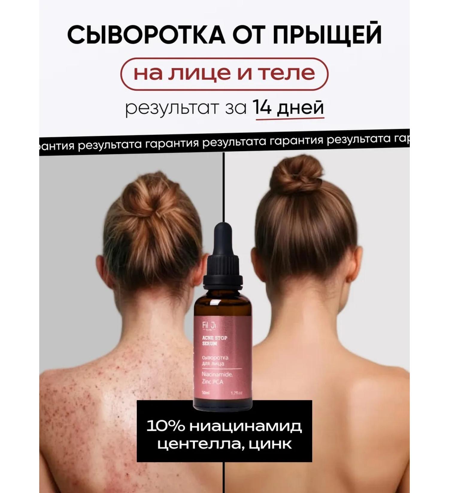 Fil Ji Permis from acne and black dots for skin and body skin - Buy Online on GoSupps.com