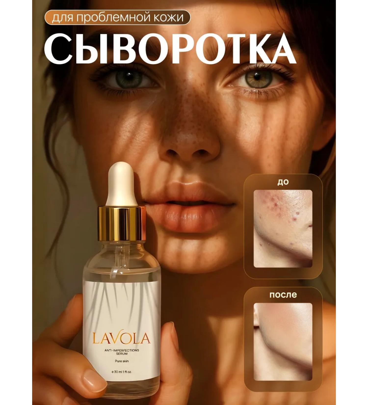 LAVOLA Facial serum from acne and acne 30 ml - Buy Online on GoSupps.com