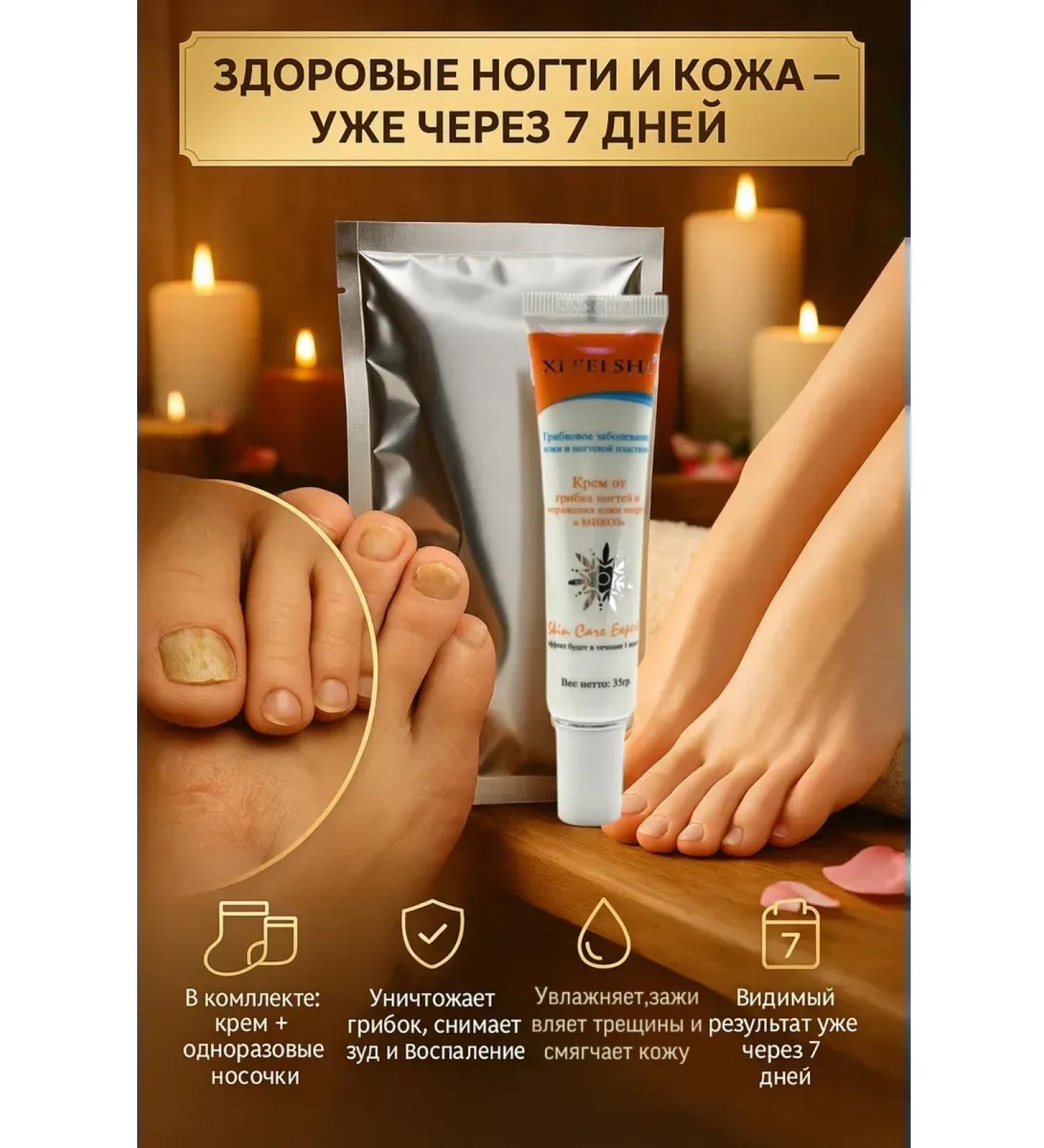 msi Feet cream from nail fungus set - Buy Online on GoSupps.com