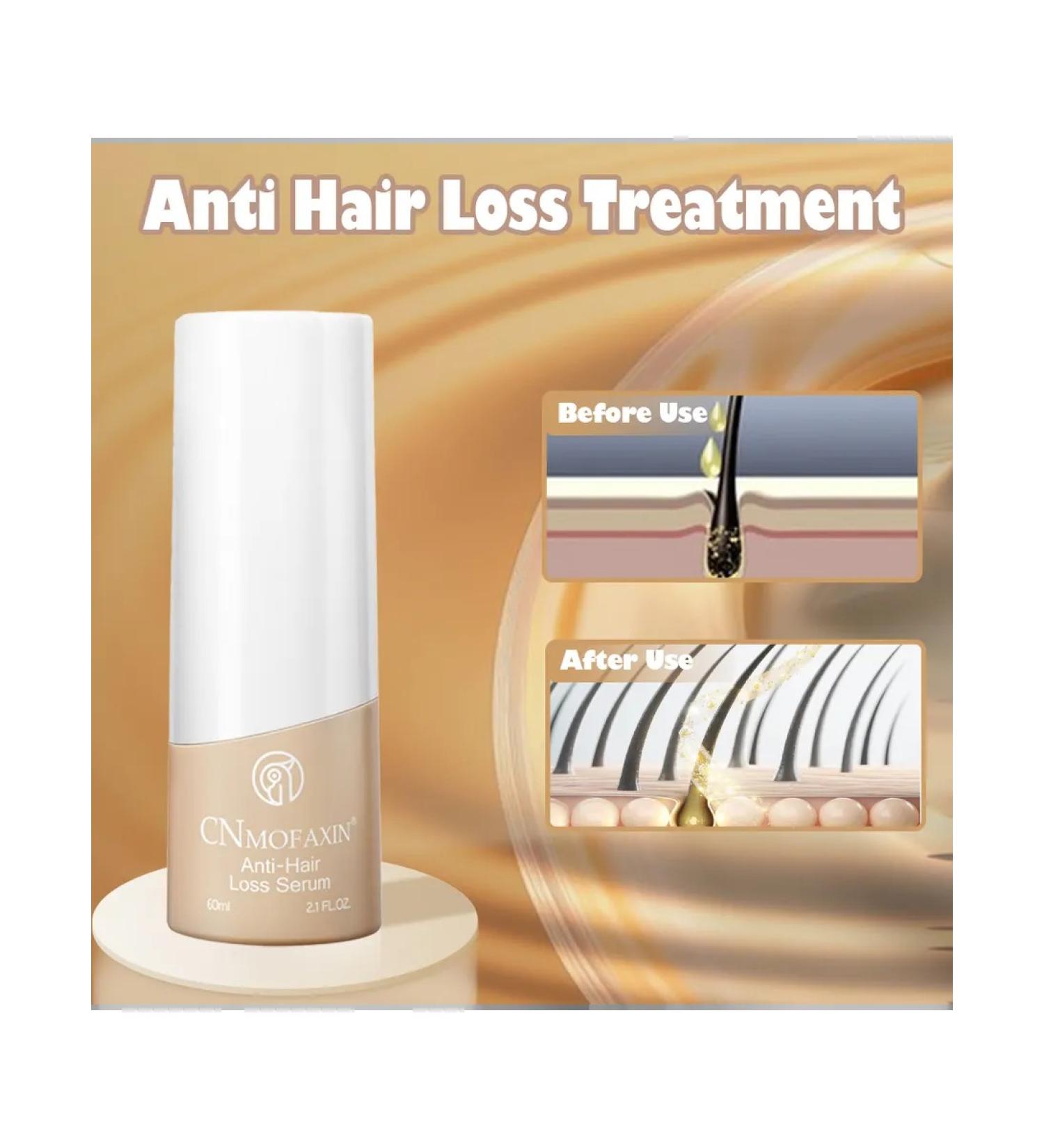 CNMOFAXIN Serum for growth and against hair loss - Buy Online on GoSupps.com