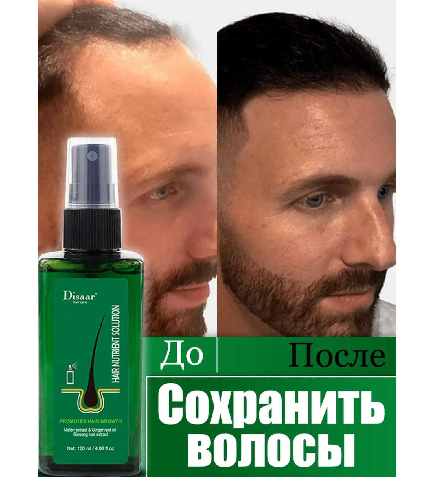 Disaar Hair loss to grow hair - Buy Online on GoSupps.com