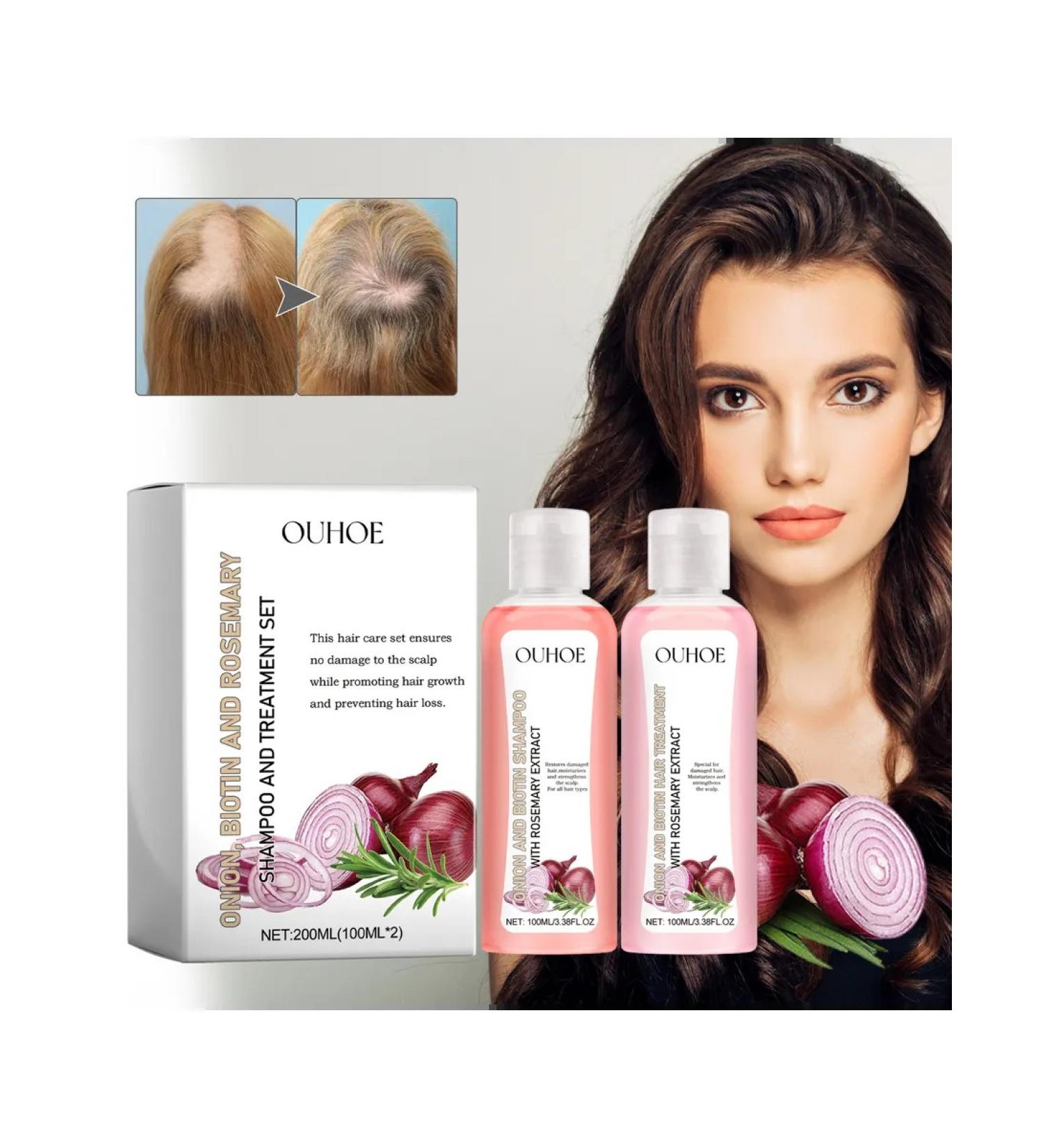 Onions+biotin strengthens hair stimulates growth - Buy Online on GoSupps.com