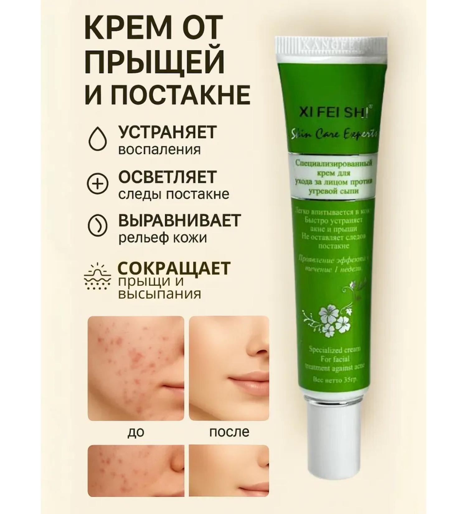 Your purchases Facial cream for acne with azelainic acid - Buy Online on GoSupps.com