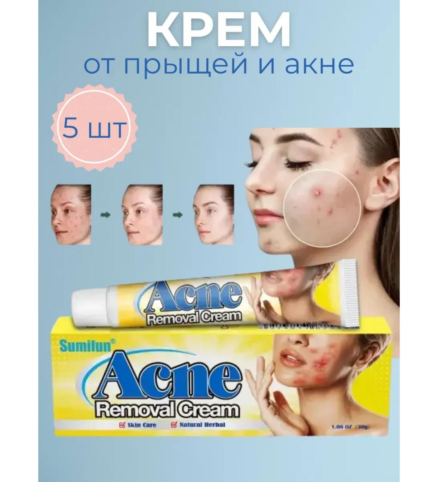 wwwbeauty Acne cream acne and black dots - Buy Online on GoSupps.com