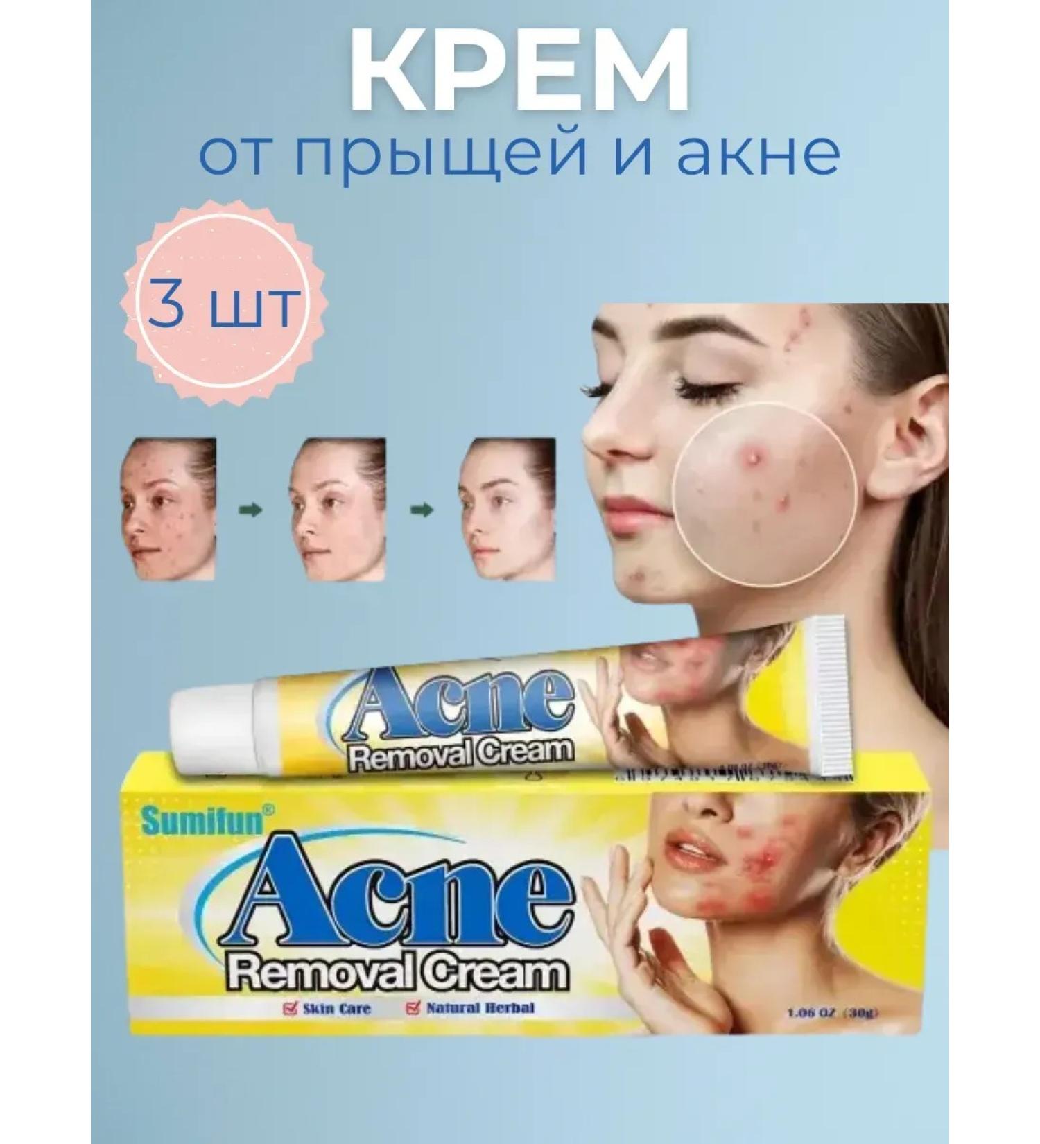 wwwstil Acne cream acne and black dots - Buy Online on GoSupps.com