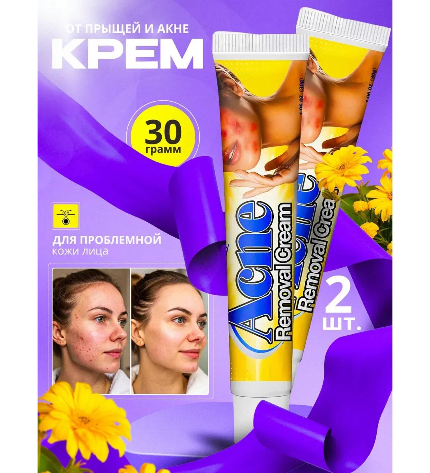 Traditional Chinese Medicine Acne cream and acne on the face and body 2 pieces - Buy Online on GoSupps.com