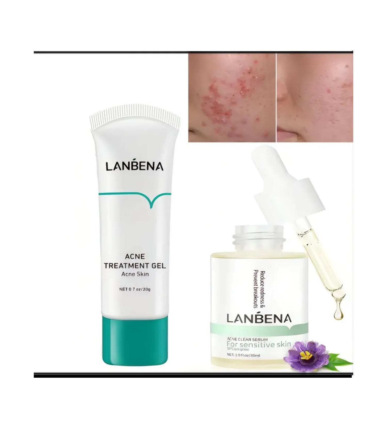 LANBENA from acne from acne gel+ serum - Buy Online on GoSupps.com