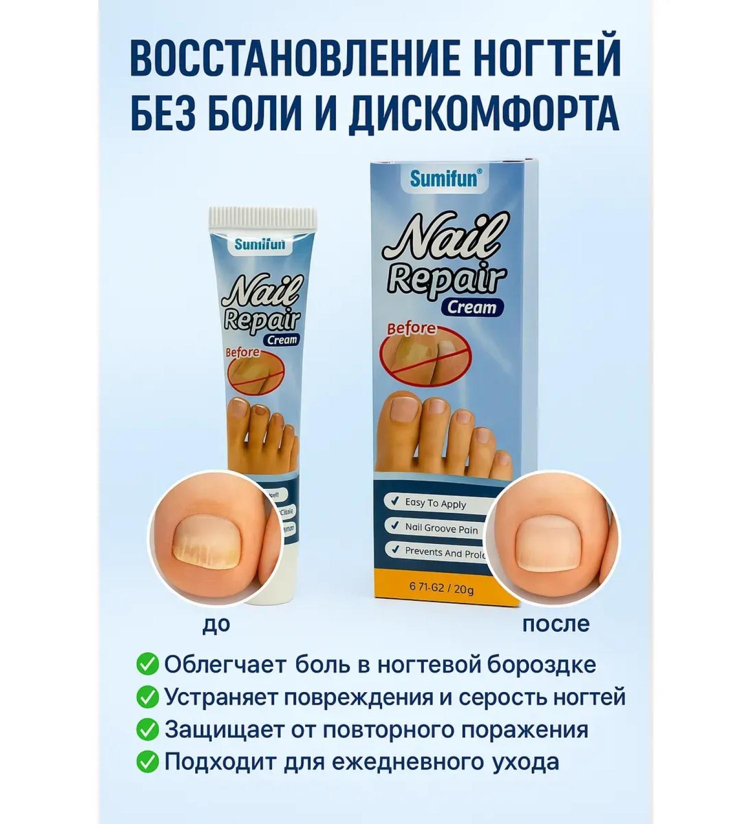 Aurexen To restore nails cream - Buy Online on GoSupps.com