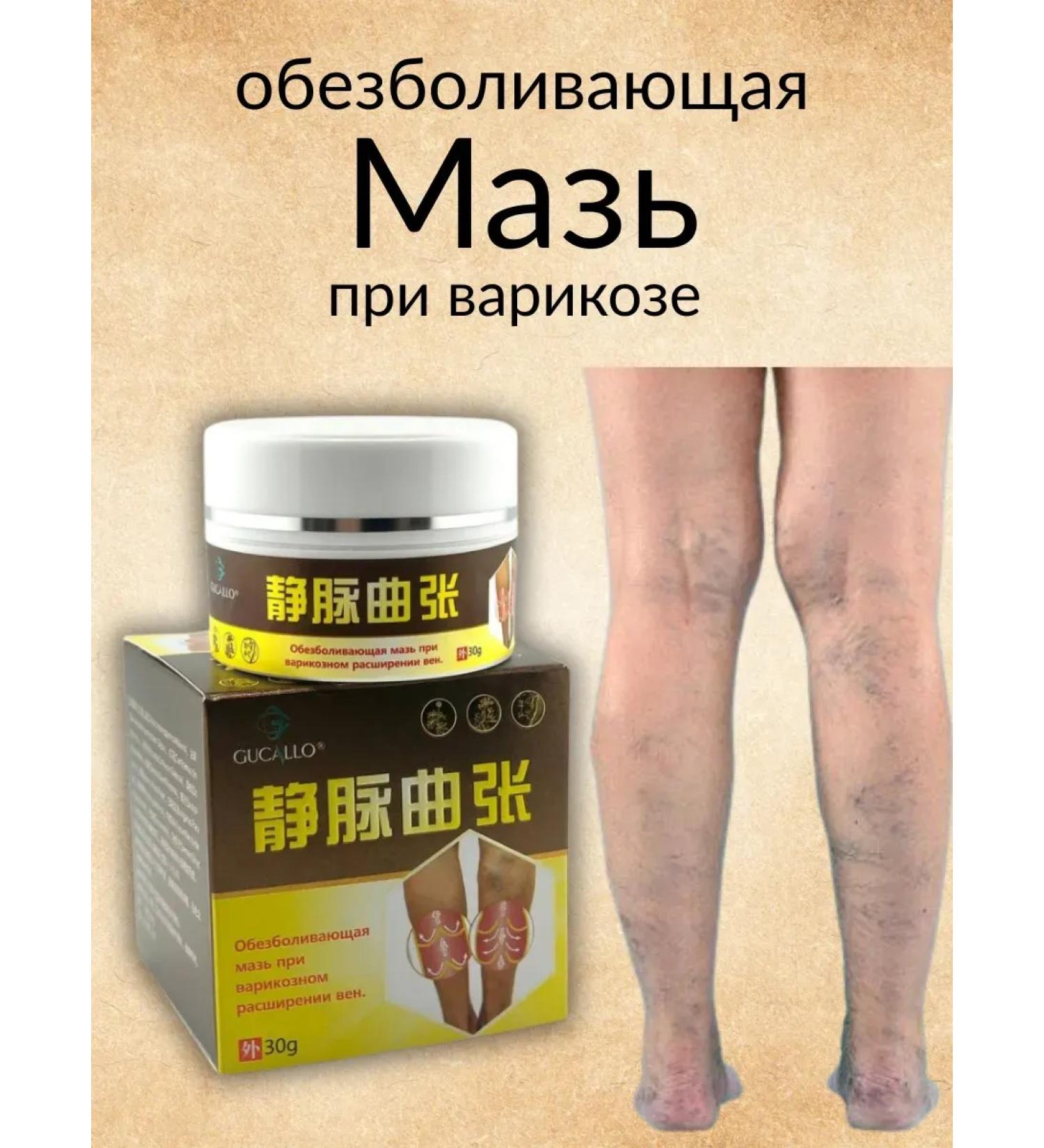 BahZara Anesthetic ointment for varicose veins - Buy Online on GoSupps.com