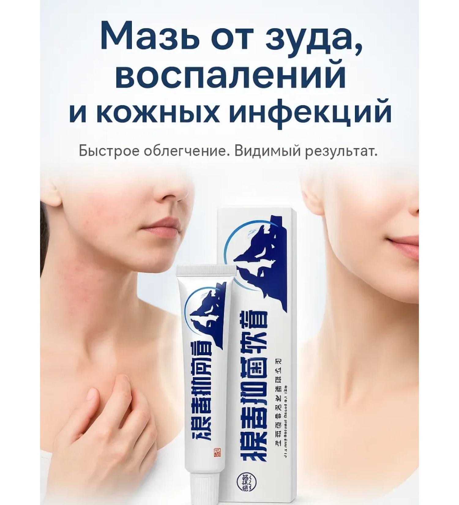 KE2 Ointment from bite of mosquitoes of rashes of allergy inflammation on the skin - Buy Online on GoSupps.com