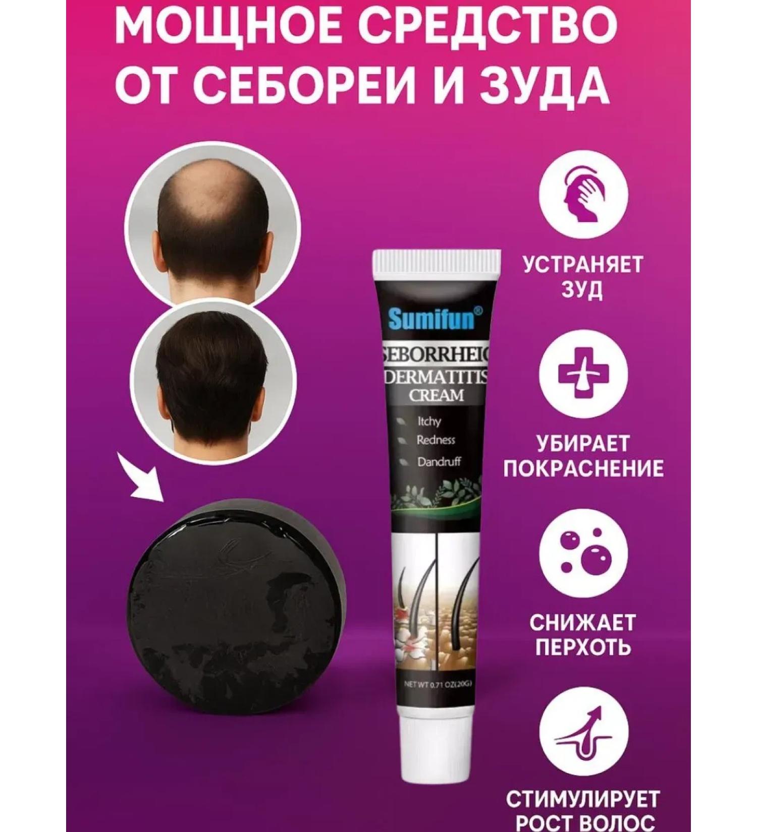 TopShopchik Cream for seborrhene dermatitis and solid soap shampoo - Buy Online on GoSupps.com