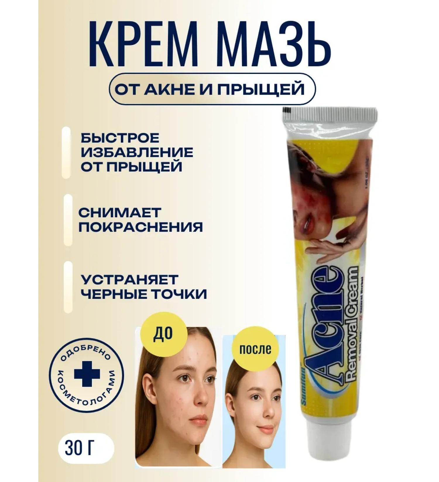 Life1 Cream ointment from acne and acne acne and post -acne effective - Buy Online on GoSupps.com