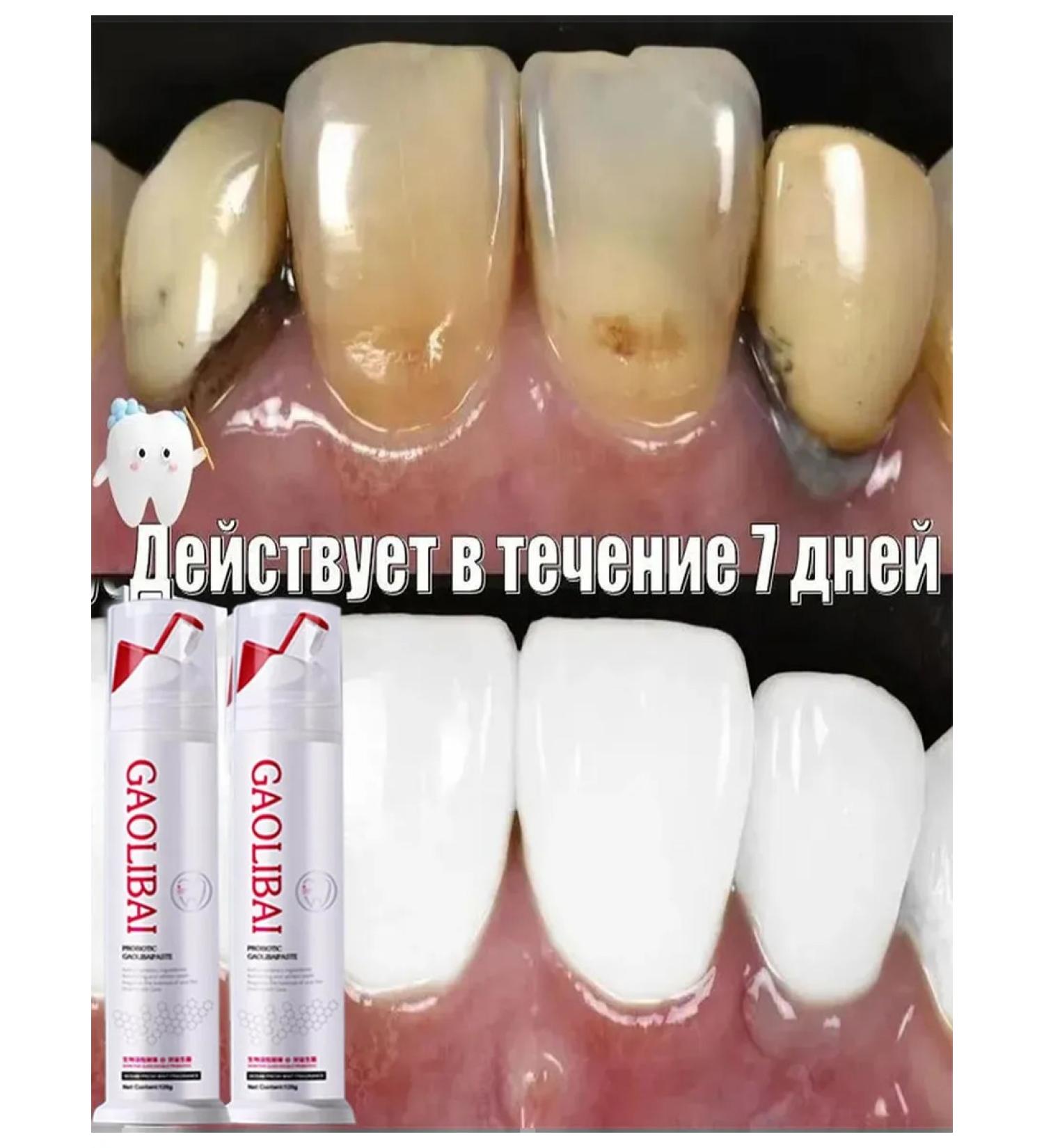 Toothpaste whitening with a probiotic 120g - Buy Online on GoSupps.com