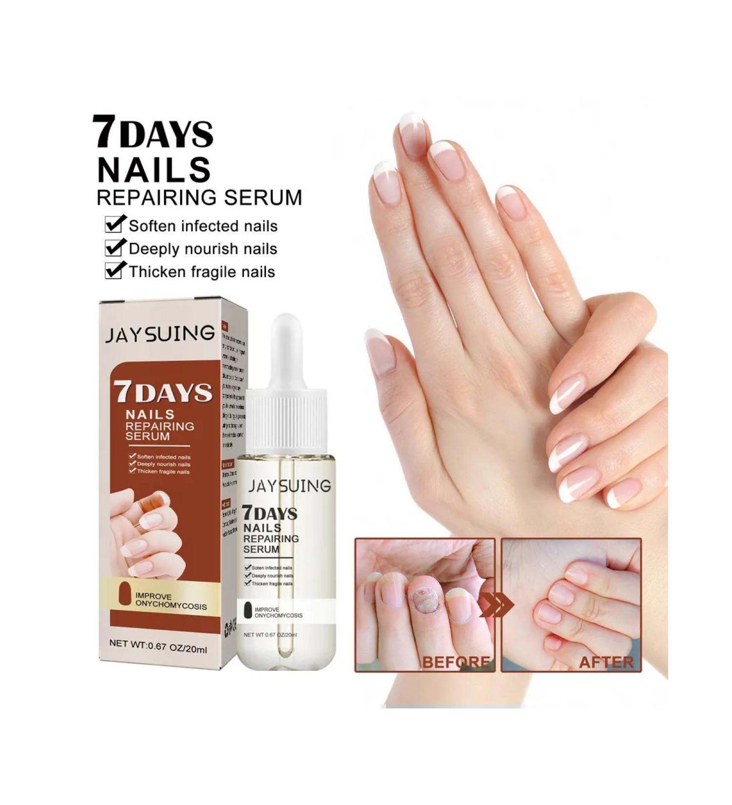 JaySuing nail care for 7 days - Buy Online on GoSupps.com