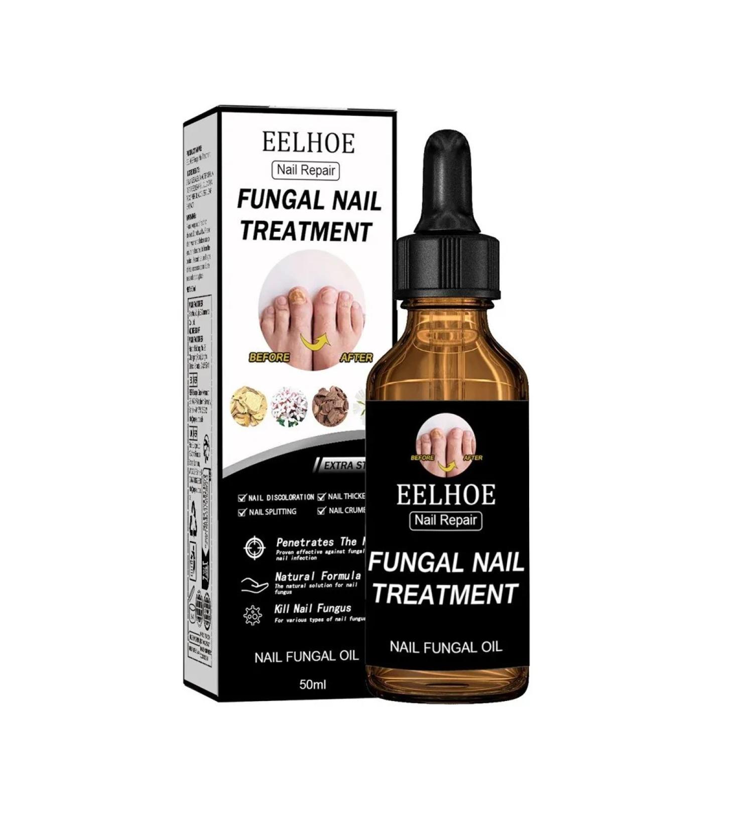 eelhoe thickening nails Care restoring cracks solution 50 ml - Buy Online on GoSupps.com