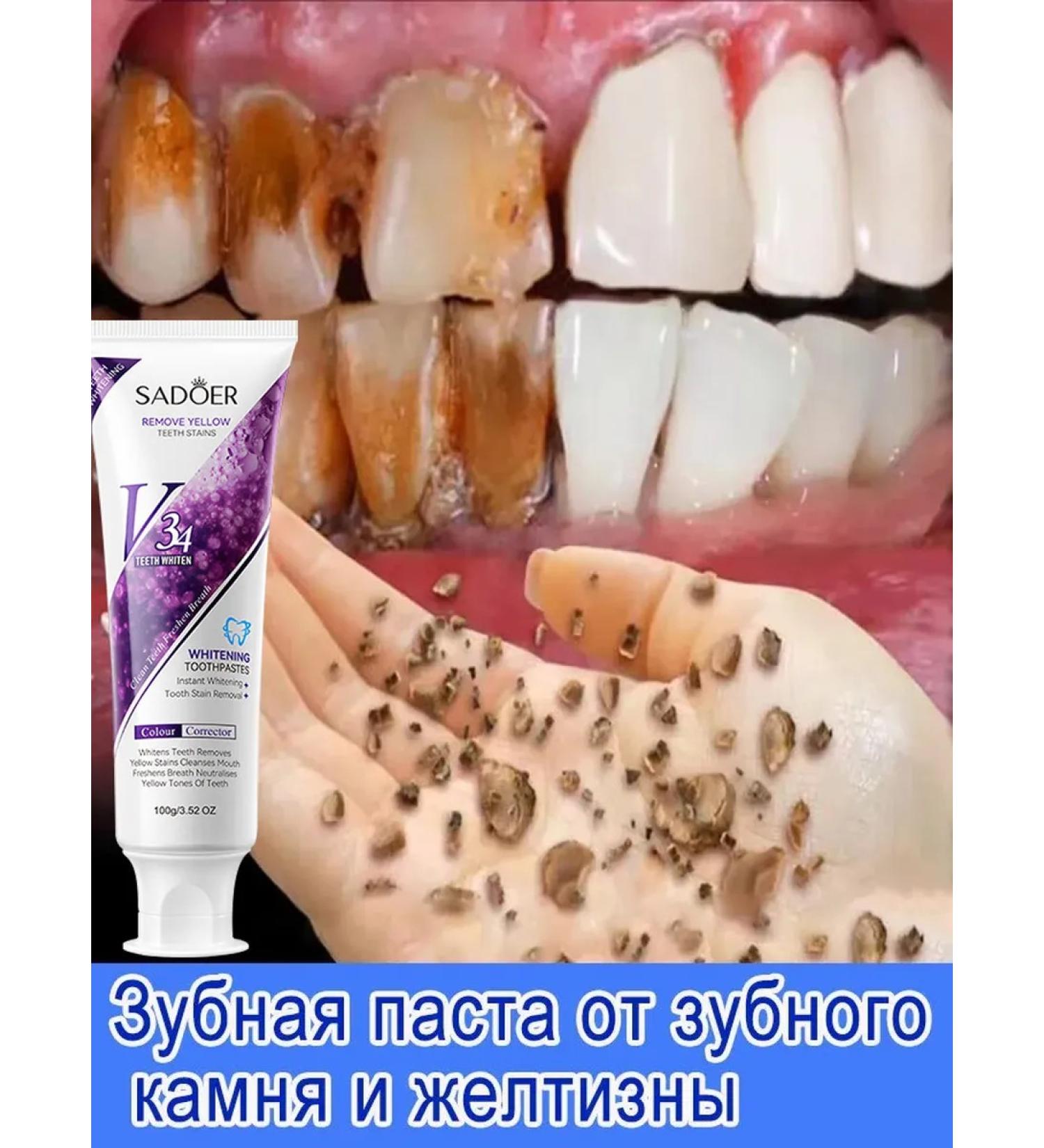 LYDIMOON Korea toothpaste whitening from plaque and caries 100 g - Buy Online on GoSupps.com