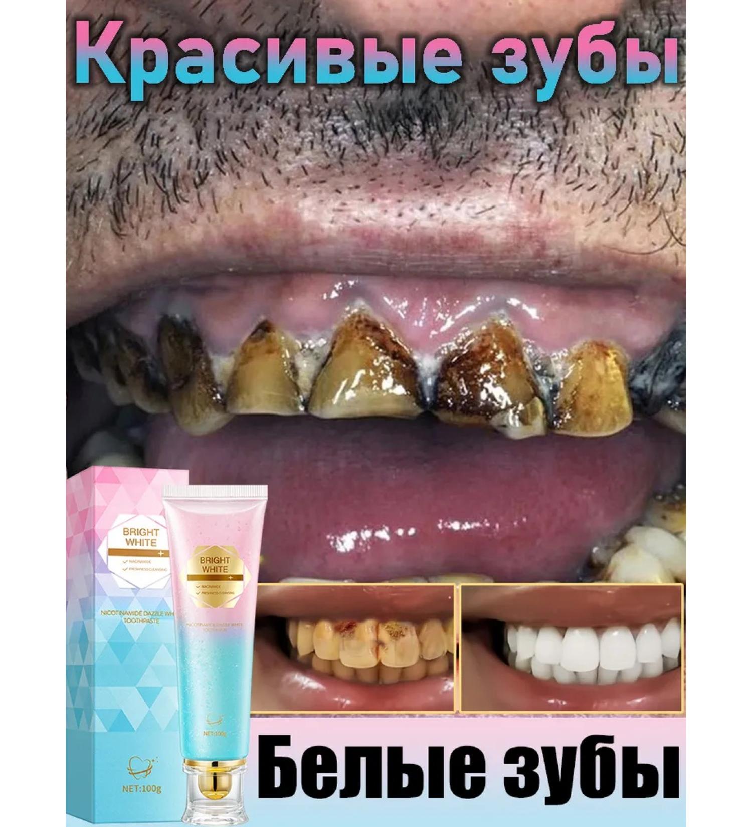 Super bleaching toothpaste teeth whitening agent - Buy Online on GoSupps.com