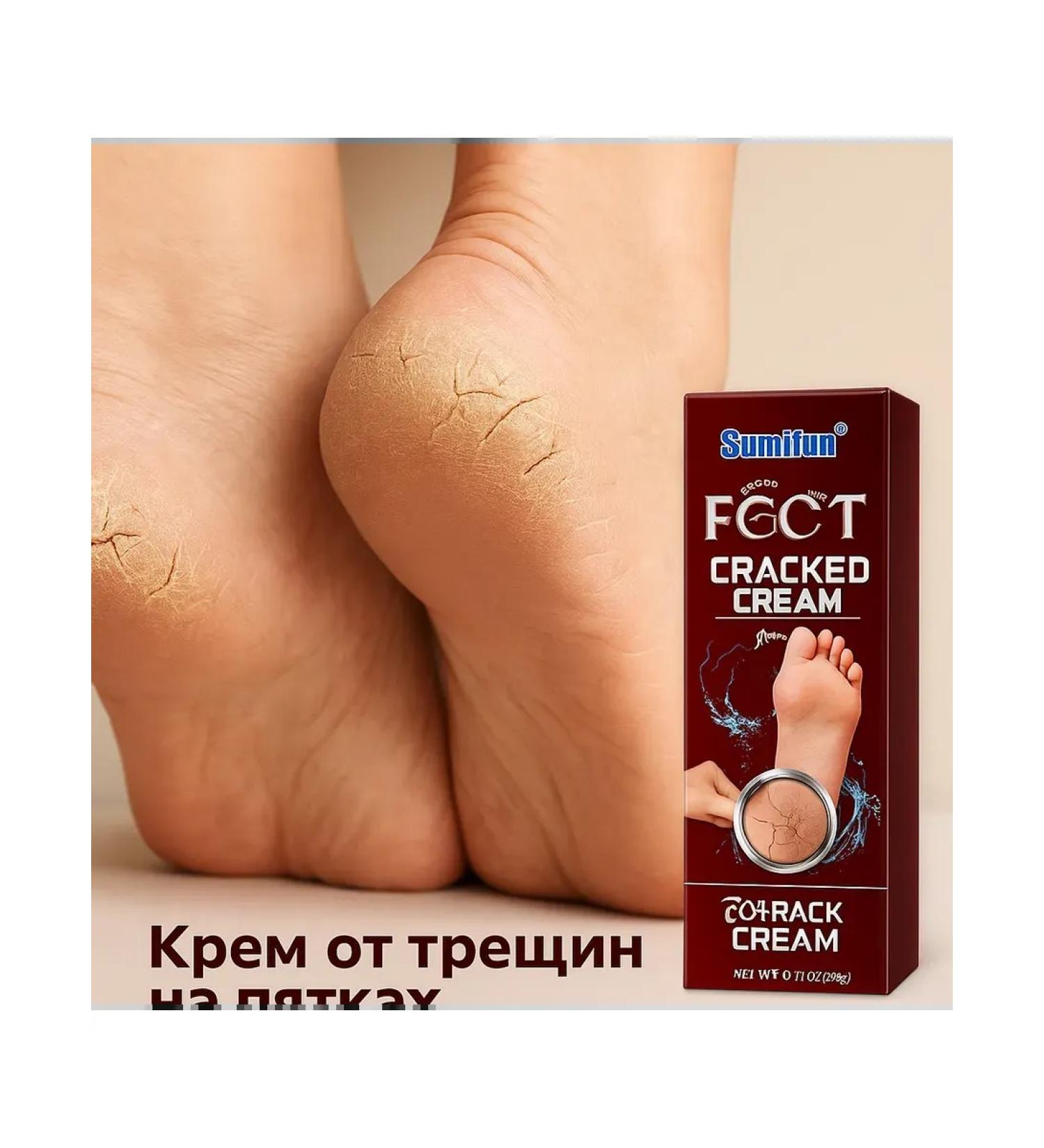 Granataris 1 Cream from cracks on the heels of coarse skin and corns - Buy Online on GoSupps.com