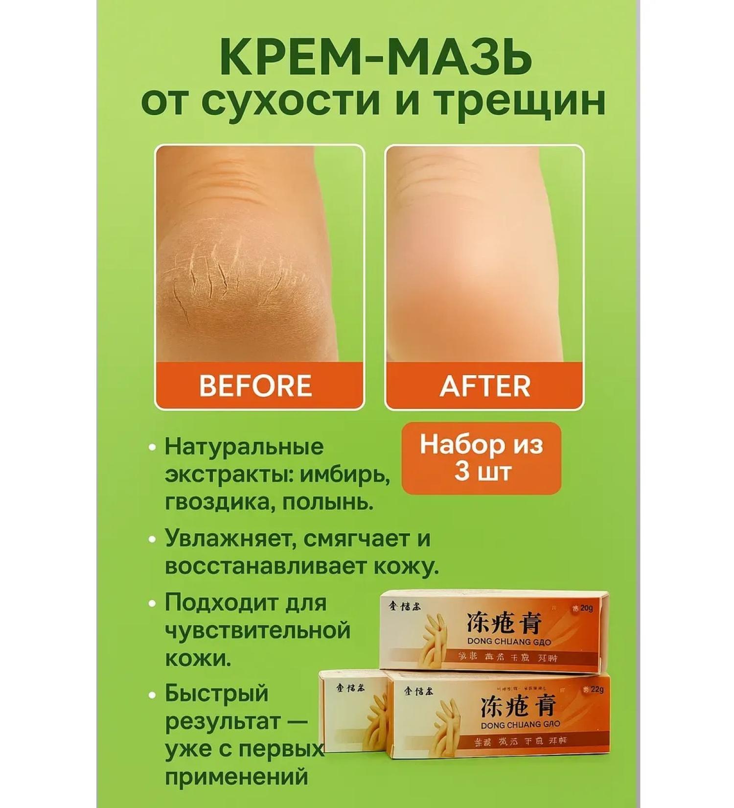 TOCHKA1000 Crack ointment on the heels healing - Buy Online on GoSupps.com