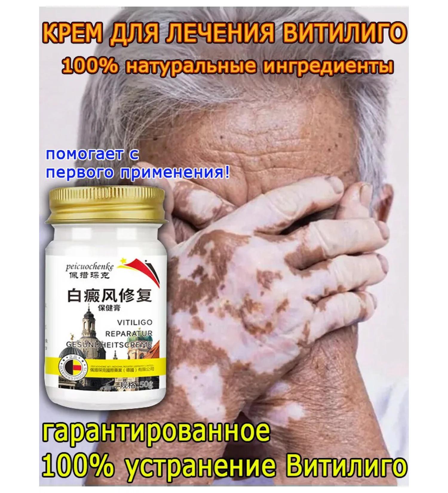 Vitiligo cream of white skin spots - Buy Online on GoSupps.com
