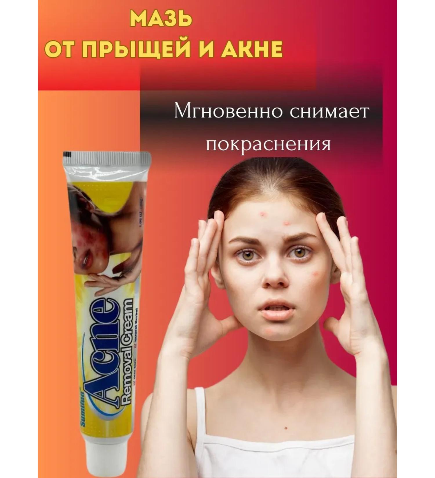 My Sweet Home Acne cream against acne - Buy Online on GoSupps.com