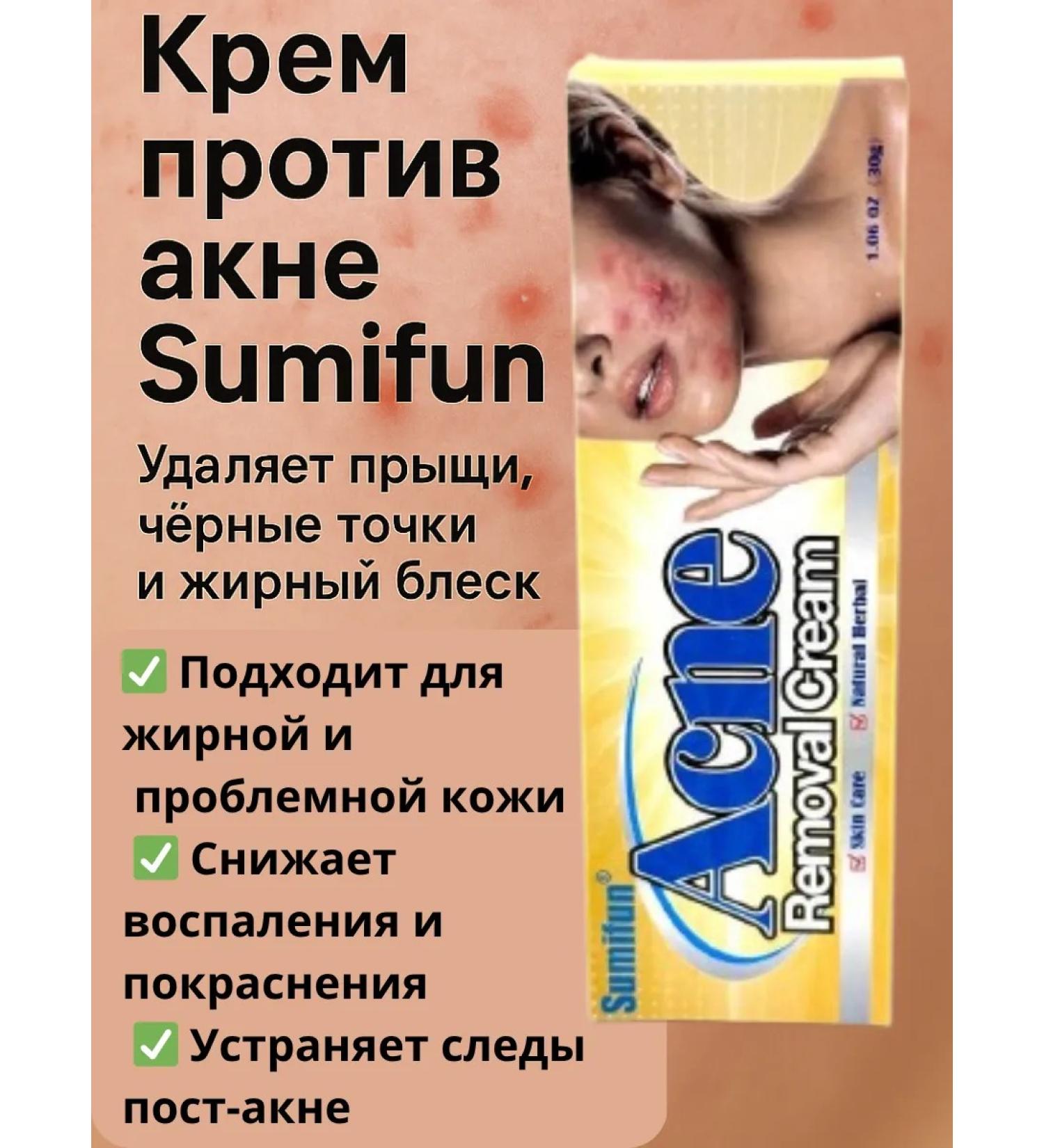 Zhyldyz Acne and acne cream - Buy Online on GoSupps.com