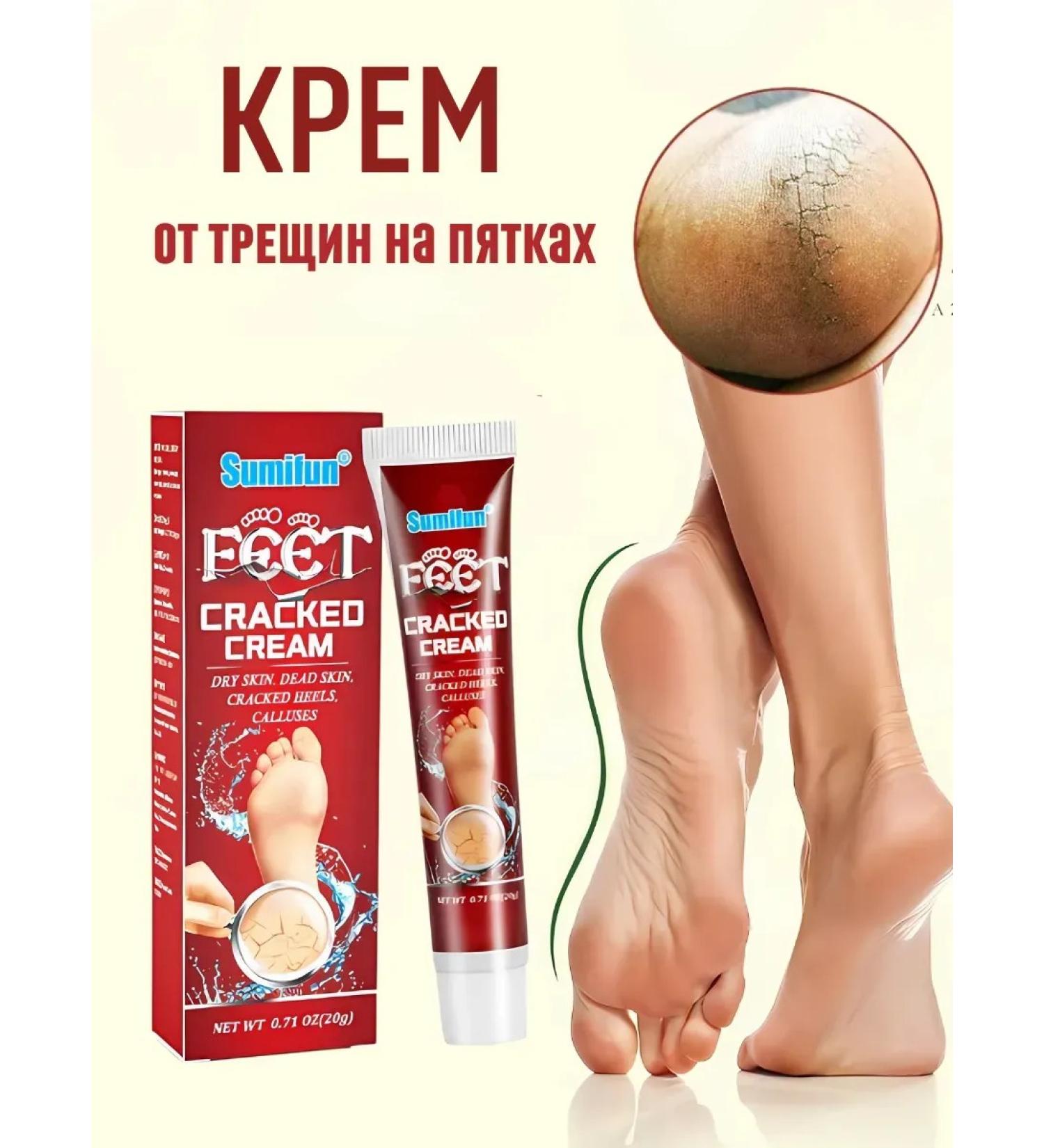 Barynch Cream-tool from cracks on heels healing legs peeling - Buy Online on GoSupps.com
