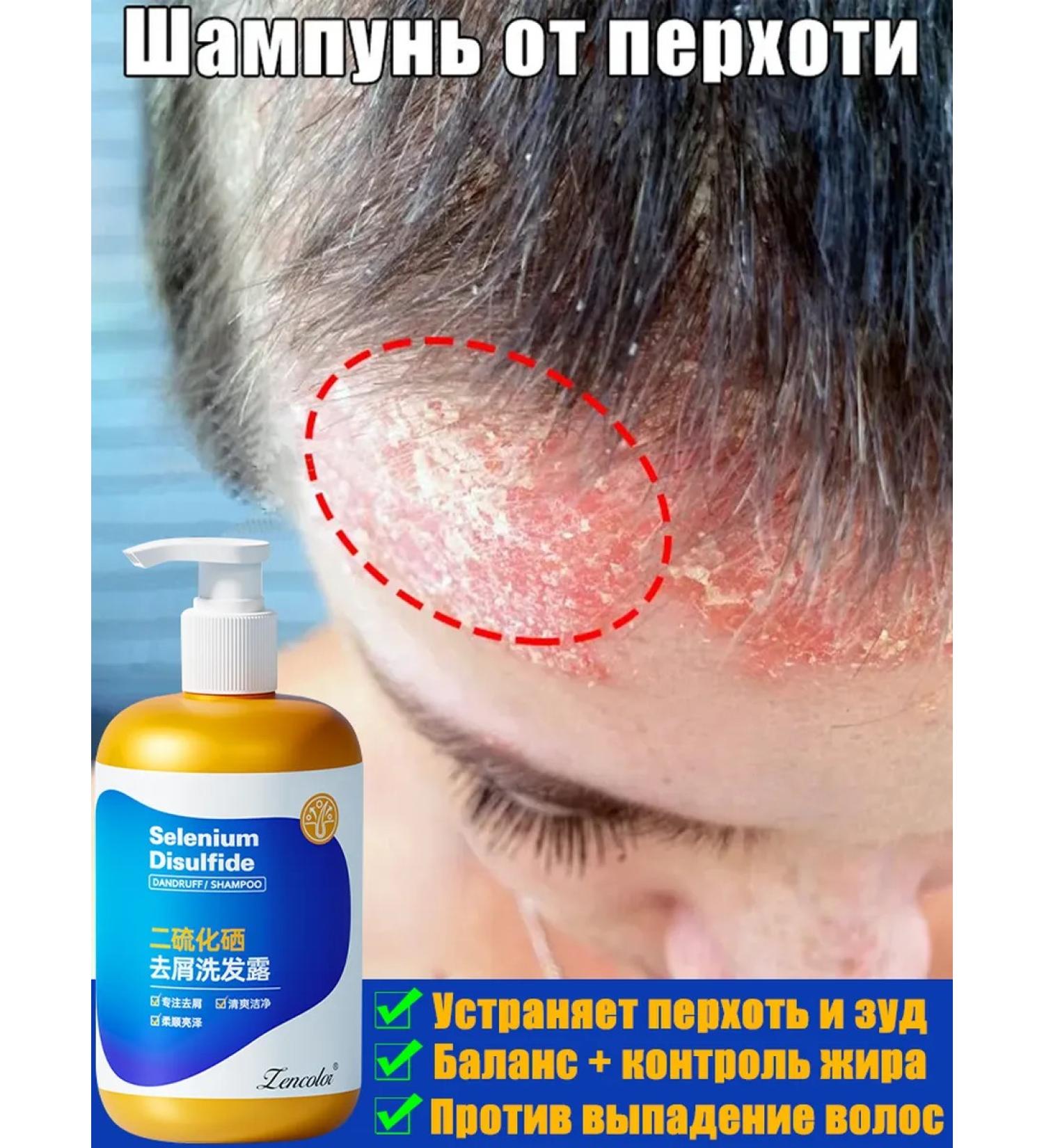 Shampoo for quickly eliminating itching and dandruff - Buy Online on GoSupps.com