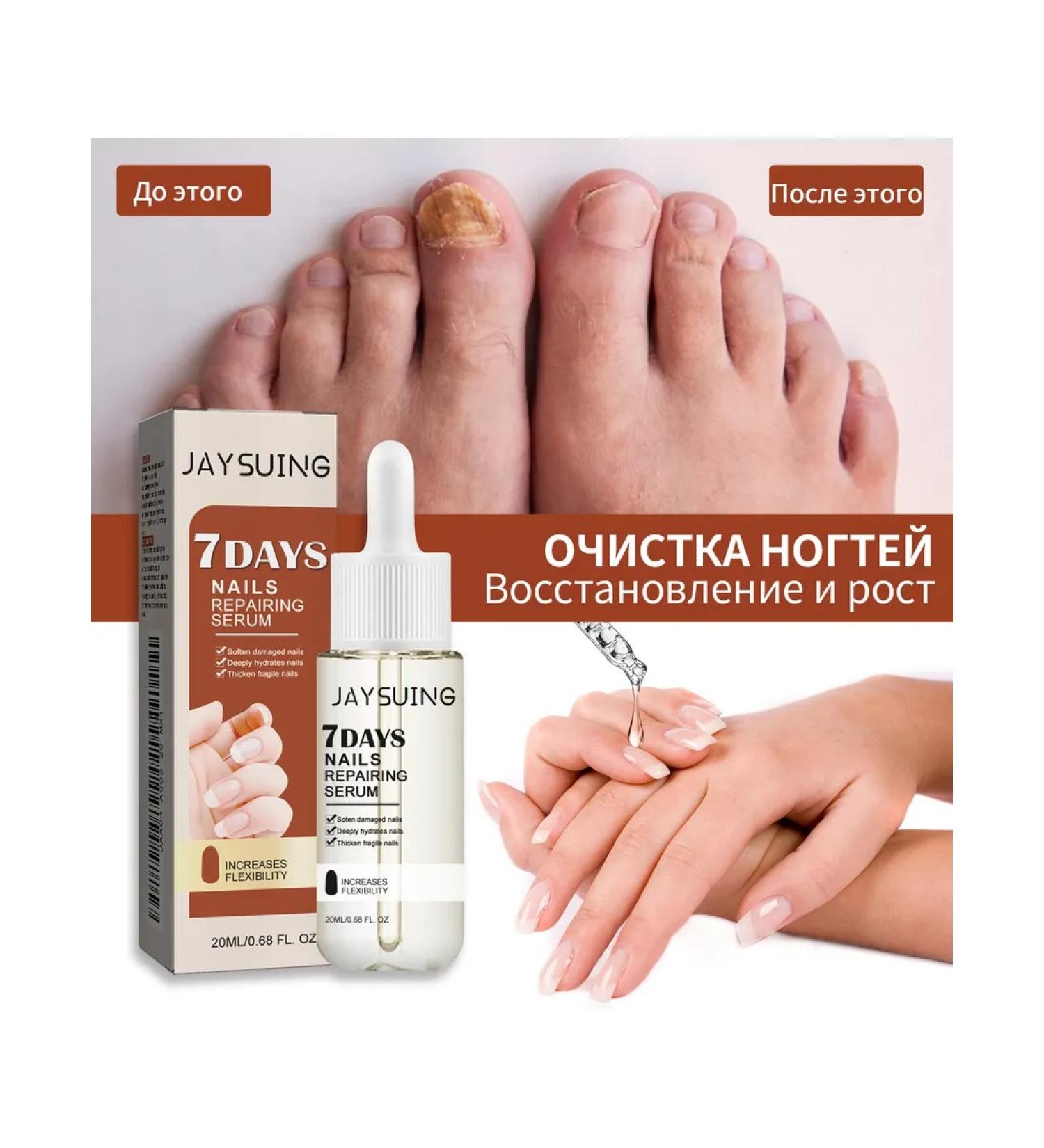 Wheezer to care for nails2 pcs - Buy Online on GoSupps.com