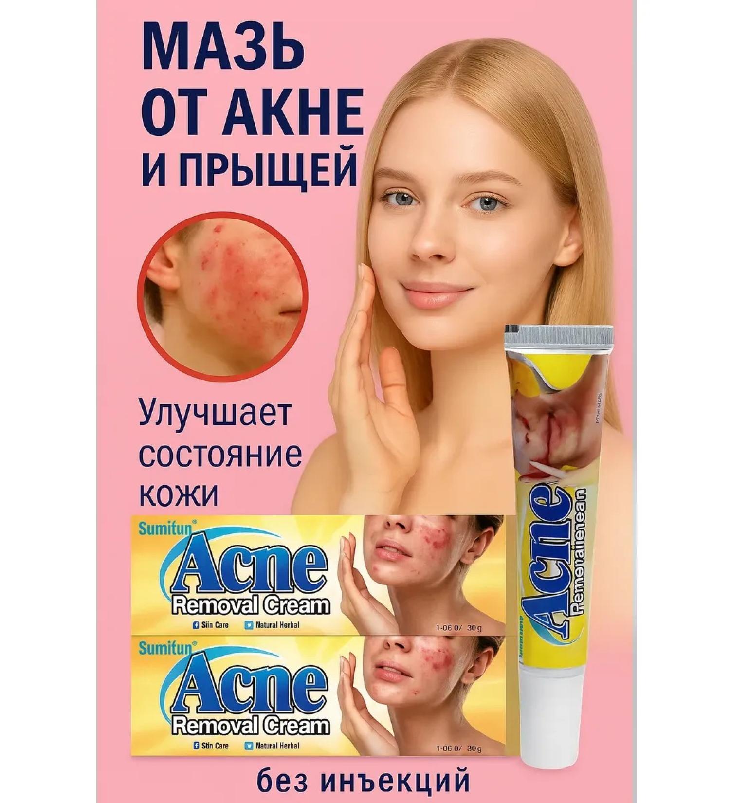 No Complaints Acne cream for teenagers - Buy Online on GoSupps.com