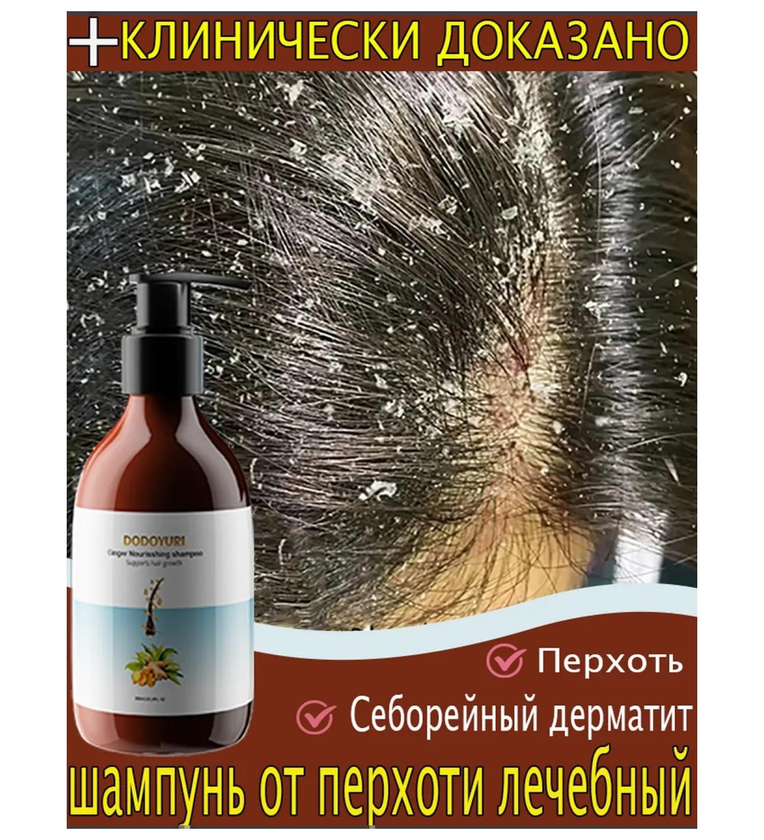 Dodoyuri intense shampoo against dandruff 300 ml - Buy Online on GoSupps.com