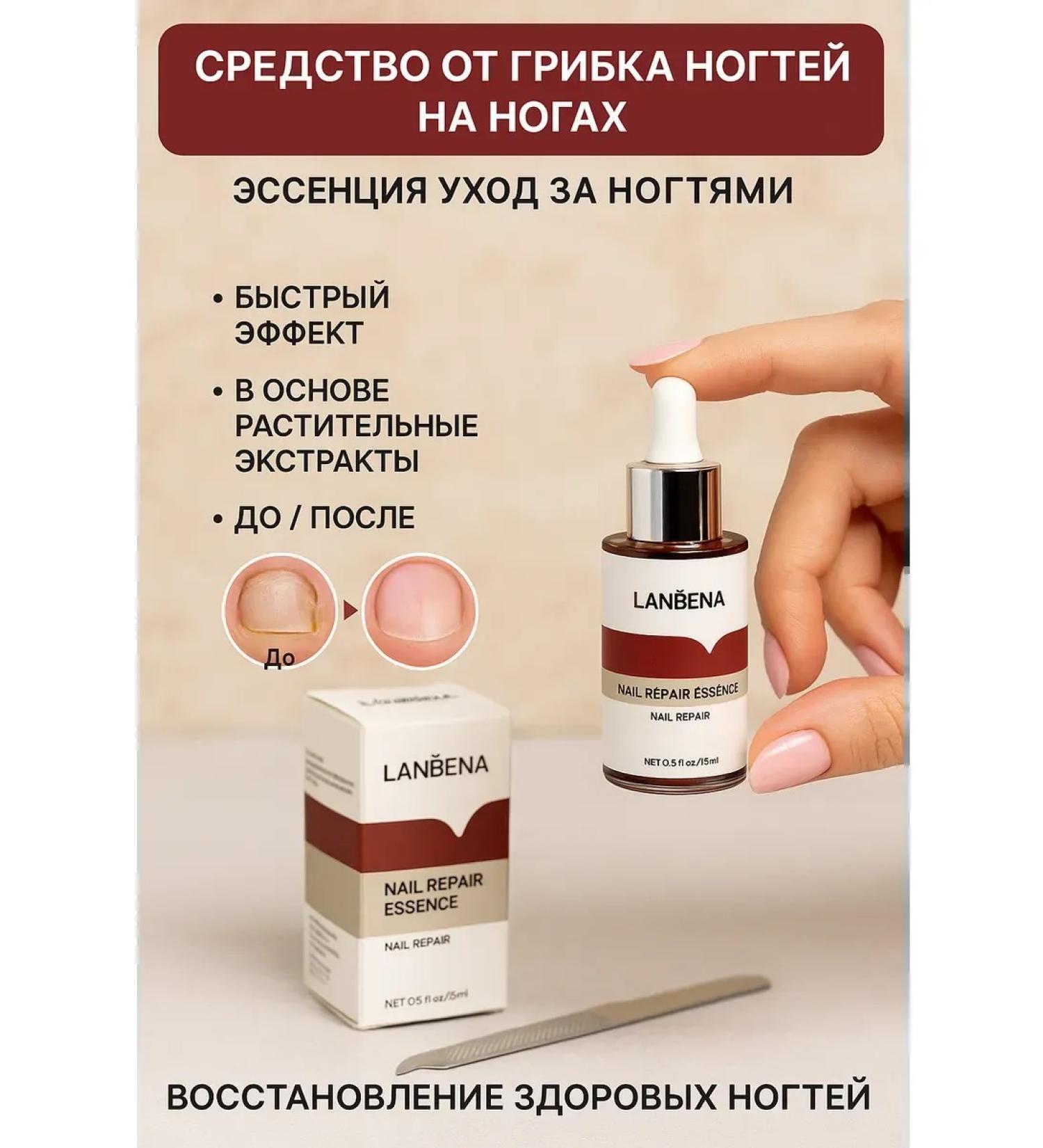 kosmosKS Remedy for nail fungus on the legs Essence Nail Care - Buy Online on GoSupps.com