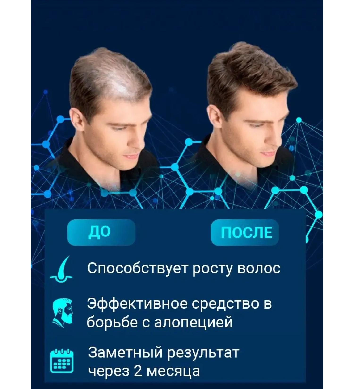 LotionPro Hair growth lotion 5% 4 pcs - Buy Online on GoSupps.com